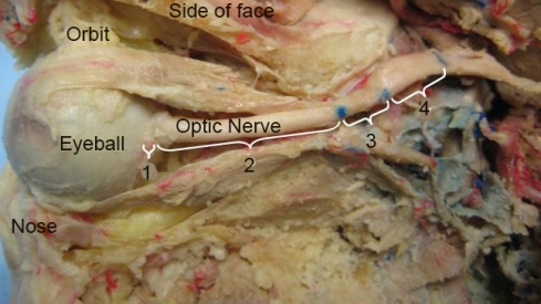 Optic_nerve_parts